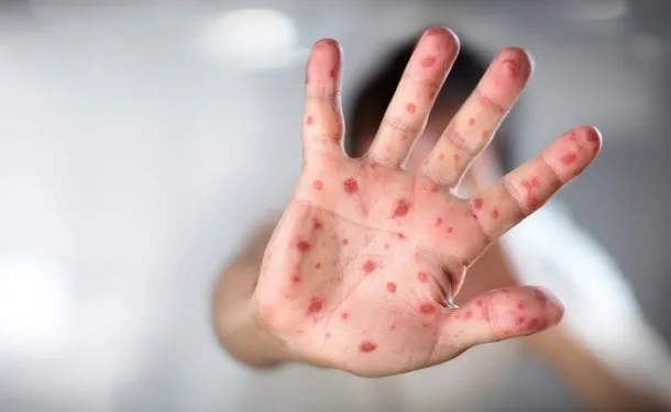 Зображення до новини