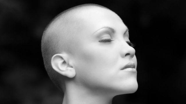 “Красива завжди”: вінничани створюють фотопроєкт про онкоодужуючих жінок