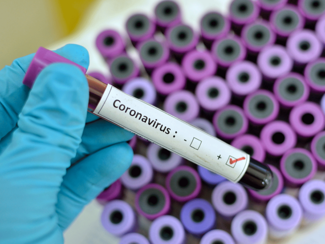 На Вінниччині визначили лікарні, у яких прийматимуть хворих на коронавірус