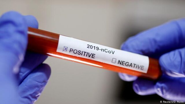 Експрес-тести для виявлення коронавірусу Covid-19 мають з’явитися на Вінниччині найближчим часом