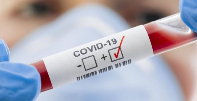 Вінницький “Міський лікувально-діагностичний центр” закупив 100 тестів для виявлення коронавірусу