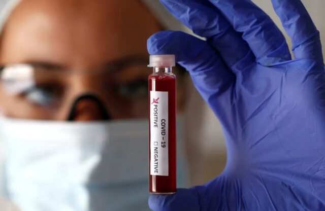 У декількох співробітників центру онкології у Вінниці виявили коронавірус
