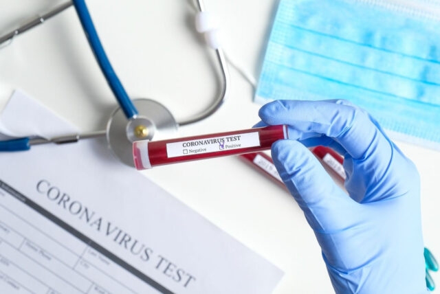 У Вінниці просять тестувати на коронавірус усіх пацієнтів з пневмонією та симптомами ГРВІ