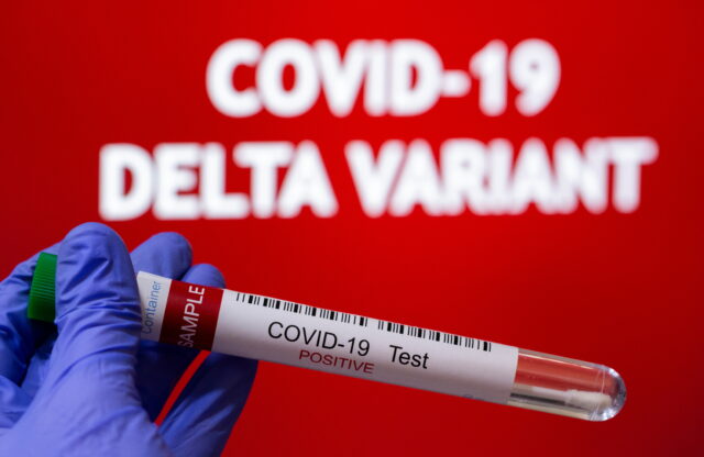 У 39 із 40 зразків: на Вінниччині поширюється мутований штам коронавірусу “Дельта”