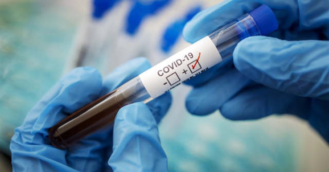 В Україні за добу – рекордна кількість нових випадків інфікування коронавірусом та смертей від COVID-19 з початку пандемії