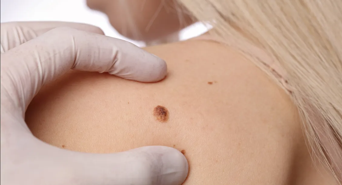 Зображення до новини