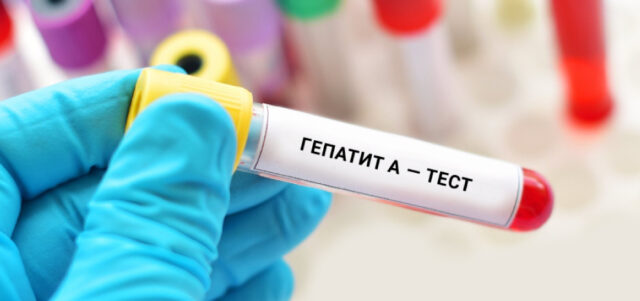 Гепатит А на Вінниччині: на стаціонарному лікуванні перебуває 144 людини