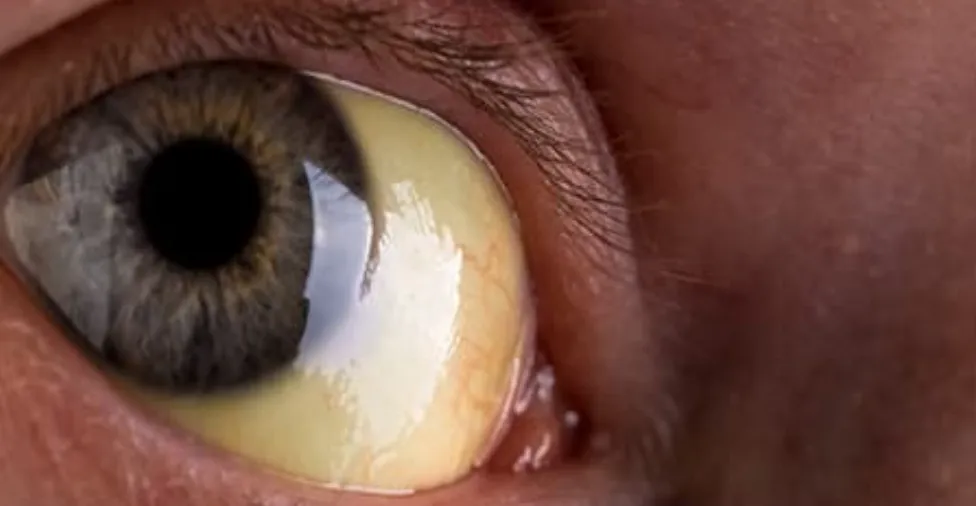 Зображення до новини