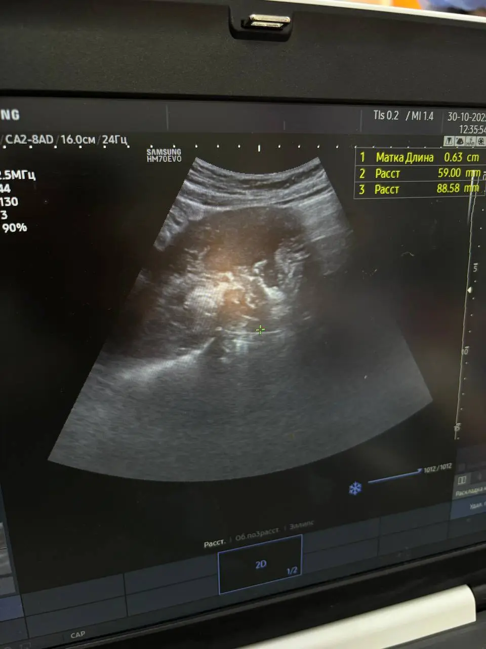 577870002_704930805992771_588866103984314790_n - Vежа